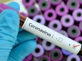 Salud Pública reporta 21 nuevos casos de coronavirus